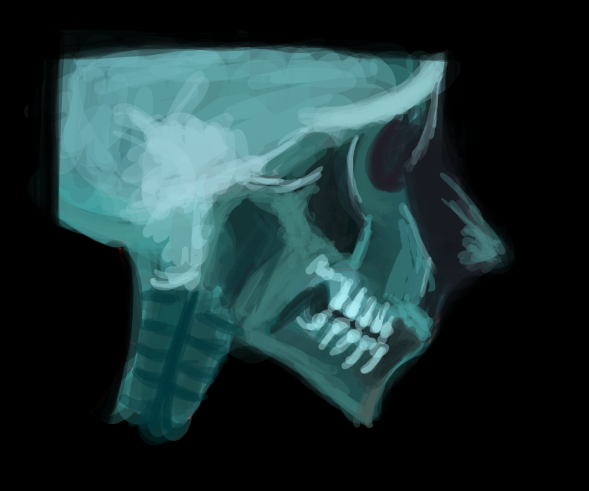 skull.png